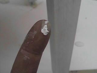Finger